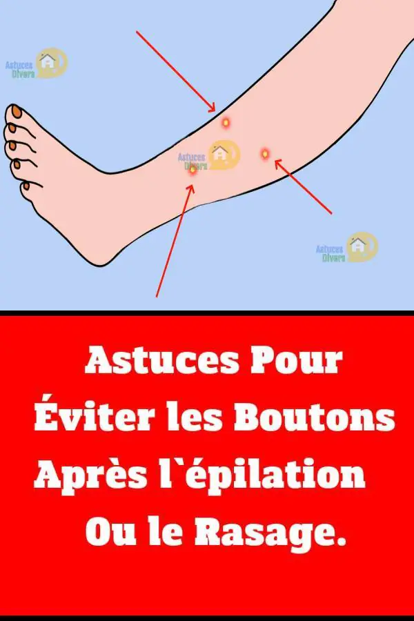 épilation après rasage
